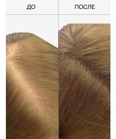 MINDLY Hair Booster magnesium oil for hair growth - Buy Online on GoSupps.com