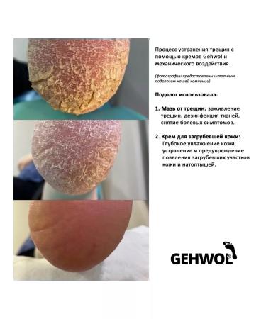 Gehwol Cream from cracks on heels 125ml - Buy Online on GoSupps.com