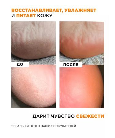 MIXIT Moisturizer with urea for legs and heels softening - Buy Online on GoSupps.com