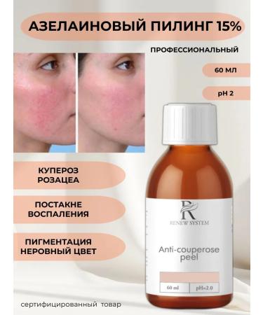 RENEV SYSTEM Facial peeling from rosacea acne post -acne Azeline 15%