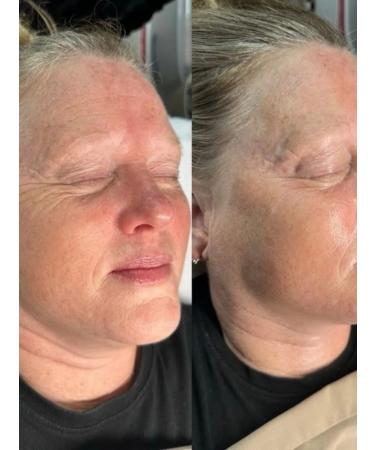 RENEV SYSTEM Peptide professional face peeling - Buy Online on GoSupps.com