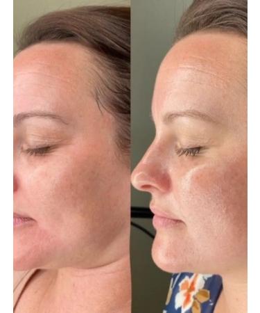 RENEV SYSTEM Peptide professional face peeling - Buy Online on GoSupps.com