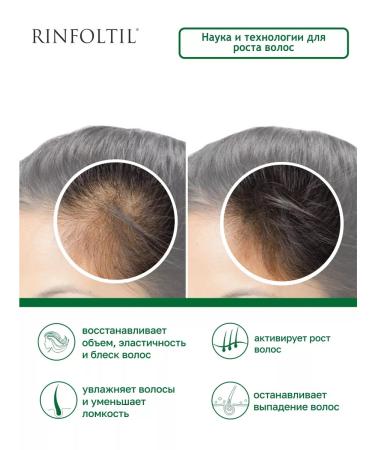 Rinfoltil Serum for intense growth and hair strengthening - Buy Online on GoSupps.com