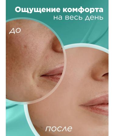 Faberlic Moisturizing day faces Hyaluronca Faberlik - Buy Online on GoSupps.com