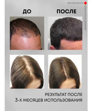 DR MARCUS HEILER Hair growth with pepper and hyaluronic acid - Buy Online on GoSupps.com