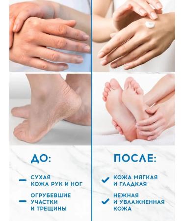 LINKRIN PROFESSIONAL Moisturizing body with urea - Buy Online on GoSupps.com