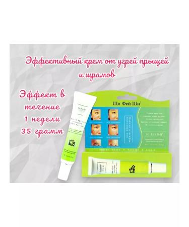 Xi Fei Shi Effective cream for removing acne of acne scars from a stroke