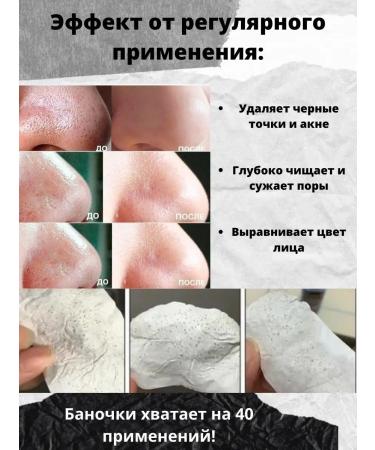 sadoer Mask from black dots acne and acne - Buy Online on GoSupps.com