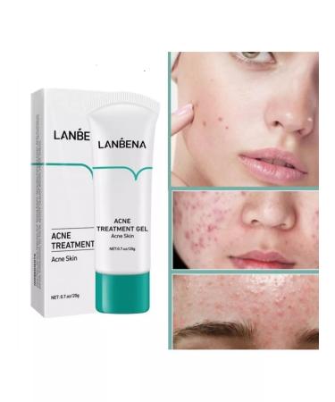 LANBENA from acne acne from rashes 20 g