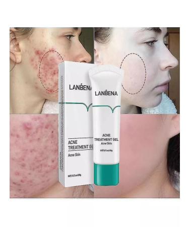 LANBENA from acne acne from rashes 20 g - Buy Online on GoSupps.com