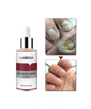 LANBENA From nail fungus on the legs 15 ml