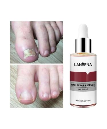 LANBENA From nail fungus on the legs 15 ml - Buy Online on GoSupps.com