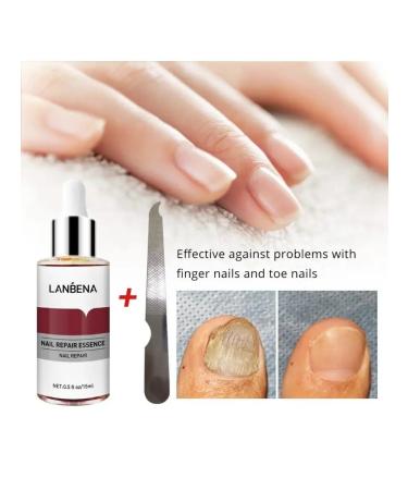 LANBENA From nail fungus on the legs 15 ml - Buy Online on GoSupps.com