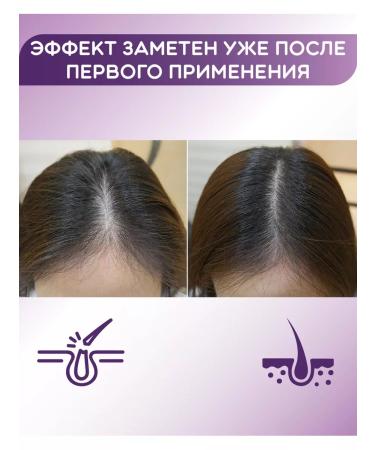 LION Therapeutic shampoo from dandruff with amino acids - Buy Online on GoSupps.com