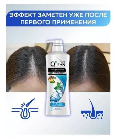 LION Mentol's dandruff shampoo - Buy Online on GoSupps.com