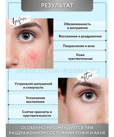 JMSolution Fabric masks for Panthelene Intensive Barrier Mask - Buy Online on GoSupps.com