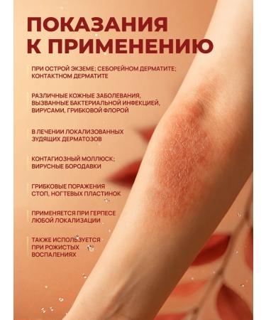 Red Lotus Ointment from psoriasis Chinese Effective 999 Pianpin 25g - Buy Online on GoSupps.com