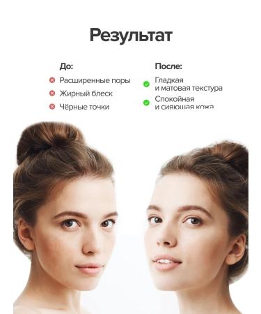 Tiam Korean Cure for narrowing pores with 20% niacinamide - Buy Online on GoSupps.com