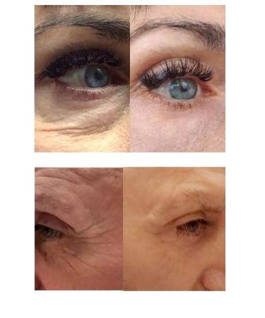 Amicell Facial and eye mask - Buy Online on GoSupps.com