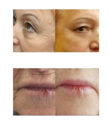 Amicell Facial and eye mask - Buy Online on GoSupps.com