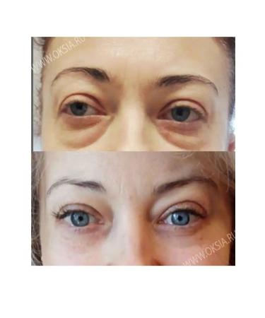 Amicell Facial and eye mask - Buy Online on GoSupps.com