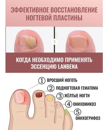 Maxim Cosmetice Nail fungus remedy - Buy Online on GoSupps.com