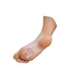 Pedifix Pedi-Gel Callus Pads - Pack of 2 Pads - Buy Online on GoSupps.com