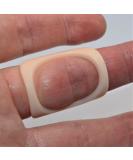 ArthroEze Oval Trigger Finger Splint Peach - Size 10.5 (63.5mm CIRC) - Buy Online on GoSupps.com