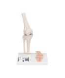 Buy 3B Scientific A85/1 Mini Knee Joint | Cross Section Bone Model | International Shipping | 3B Smart Anatomy - Buy Online on GoSupps.com