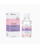 SIRUIMAO Stubborn Acne Drying Lotion - Overnight Acne Spot Treatment for Face & Body - 1 Fl Oz (Pack of 1) - Buy Online on GoSupps.com