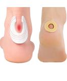 Felt Callus Pads & Foam Cushions Set - 6 Felt Pads & 45 Foam Toe Pads for Pain Relief & Protection | Comfortable Corn Cushions - International Shipping - Buy Online on GoSupps.com
