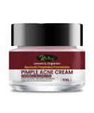 Riffway Pimple Cream & Acne Moisturizing Gel for All Skin Types | Soothing Glowing Skin No Side Effects - Shop Internationally - Buy Online on GoSupps.com