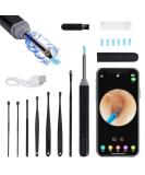 1080 HD Wireless Ear Wax Removal Camera Kit - Ear Wax Remover Tool with LED Lights for iPhone iPad & Android - Buy Online on GoSupps.com