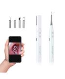 Premium Ear Wax Removal Otoscope & Curette - HD Camera with LED Lights for iPhone & Android | Ideal for Kids Adults & Pets - Buy Online on GoSupps.com