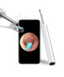 Premium Ear Wax Removal Endoscope with 1080P FHD Camera & LED Lights - Wireless Otoscope for iPhone iPad & Android - Buy Online on GoSupps.com