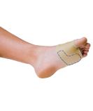 PediFix Sesamoid Relief Sleeve - Large Left | Comfortable Support for Sesamoid Pain - Buy Online on GoSupps.com