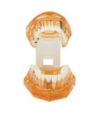 Standard Tooth Model - Removable Dental Teaching Materials for Kids & Adults | Typodont Demonstration Model - Buy Online on GoSupps.com