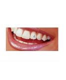 Sparkles Tooth Crystal Kit - 20 Assorted Color Crystals for Stunning Smiles | International Shipping Available - Buy Online on GoSupps.com