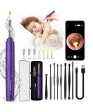 OTAONE Ear Wax Removal Tool with 1296P FHD Camera and Built-in WiFi - Purple - Buy Online on GoSupps.com