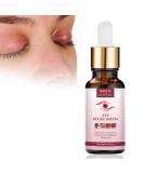 Chalazion Eye Treatment & Blepharitis Relief - 30ml Under Eye Serum for Dark Circles Puffiness & Moisturizing Eyelids - Buy Online on GoSupps.com