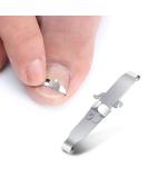 Bezox 2PCs ingrown toenail tools nail correction buckle and lifter for ingrown & paronychie treatment-surgical stainless steel (size: 41-43) - Buy Online on GoSupps.com