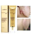 AKARY Acne Scar Removal Cream - Herbal Fade Marks Repair | Stretch Marks Face Gel | Shrink Pores & Repair Old/New Scars - Skin Care - Buy Online on GoSupps.com