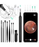 ACWOO WiFi Ear Wax Removal Otoscope - 5040P Waterproof Ear Cleaner with LED for iPhone iPad & Android - Buy Online on GoSupps.com