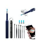 Wireless Ear Wax Removal Tool Camera - Anti-Fall Off Eartip Visual Ear Cleaner - Waterproof Otoscope Earwax Removal Kit for iPhone & Android (Blue) - Buy Online on GoSupps.com
