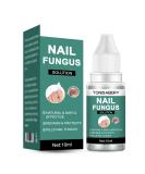 Fungal Nail Treatment for Toenail Extra Strong Ingrown Toenail Treatment Nail Care Oils Anti Toe Nail Fungus Treatment for Toenail Nail Fungal Solution Fixes Discolored Nails Safe Effective (1Pcs) - Buy Online on GoSupps.com
