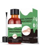 Fungal Nail Treatment - Extra Strong Nail Fungus Treatment for Toenail and Fingernail - Anti fungus Nail Repair and Strengthen Fix & Renew Damaged Broken Nails 1PC - Buy Online on GoSupps.com