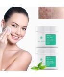 Glycolic Acid Peel Pads - 35% Exfoliating Wipes for Face & Body | Vitamin B5 & Tea Tree Oil | Minimize Pores & Uneven Skin Tone (2 Pcs 2.82oz) - International Shipping - Buy Online on GoSupps.com