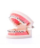 Buy Dental Orthodontic Standard Teeth Model with Metal Brackets & Wires - International Shipping Available - Buy Online on GoSupps.com