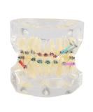 Tooth Model for Dental Orthodontic Treatment | Malocclusion Study & Teaching Aid - Buy Online on GoSupps.com