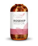 Organic Rosehip Seed Oil (2 Fl Oz) for Face - Stretch Mark & Scar Removal, Reduces Inflammation & Boosts Collagen Production - Radiant Skin & Facial Oil - Buy Online on GoSupps.com